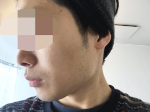 バルクオム 洗顔後
