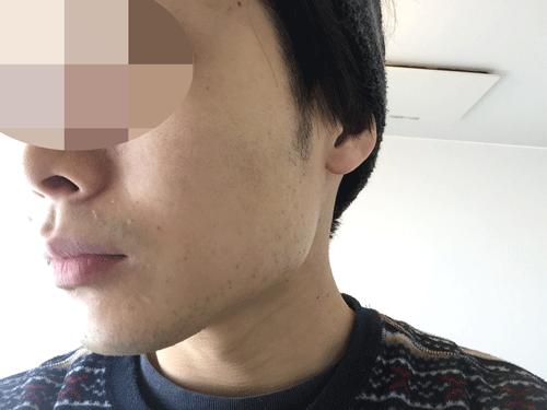 バルクオム 化粧水 つけた後