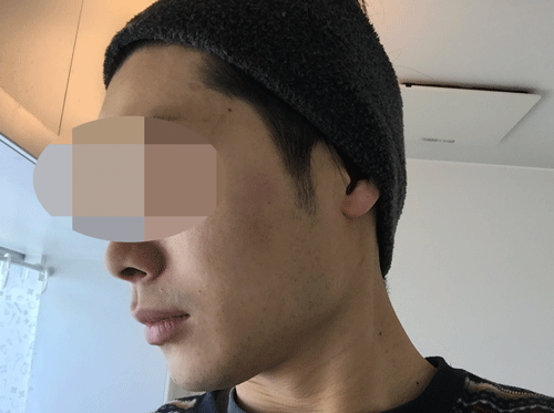 バルクオム 洗顔前